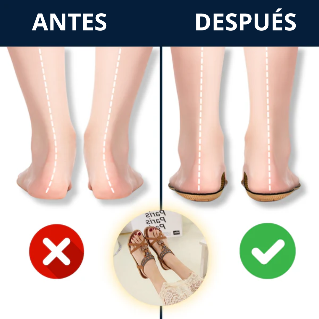 Sandalias Ergonómicas Comfort - Novedua™